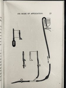 Jennings' figure of a siphon for a combined method of transfusion, including a small vessel to carry saline fluids, and a bifurcated tube that can be used for direct transfusion.